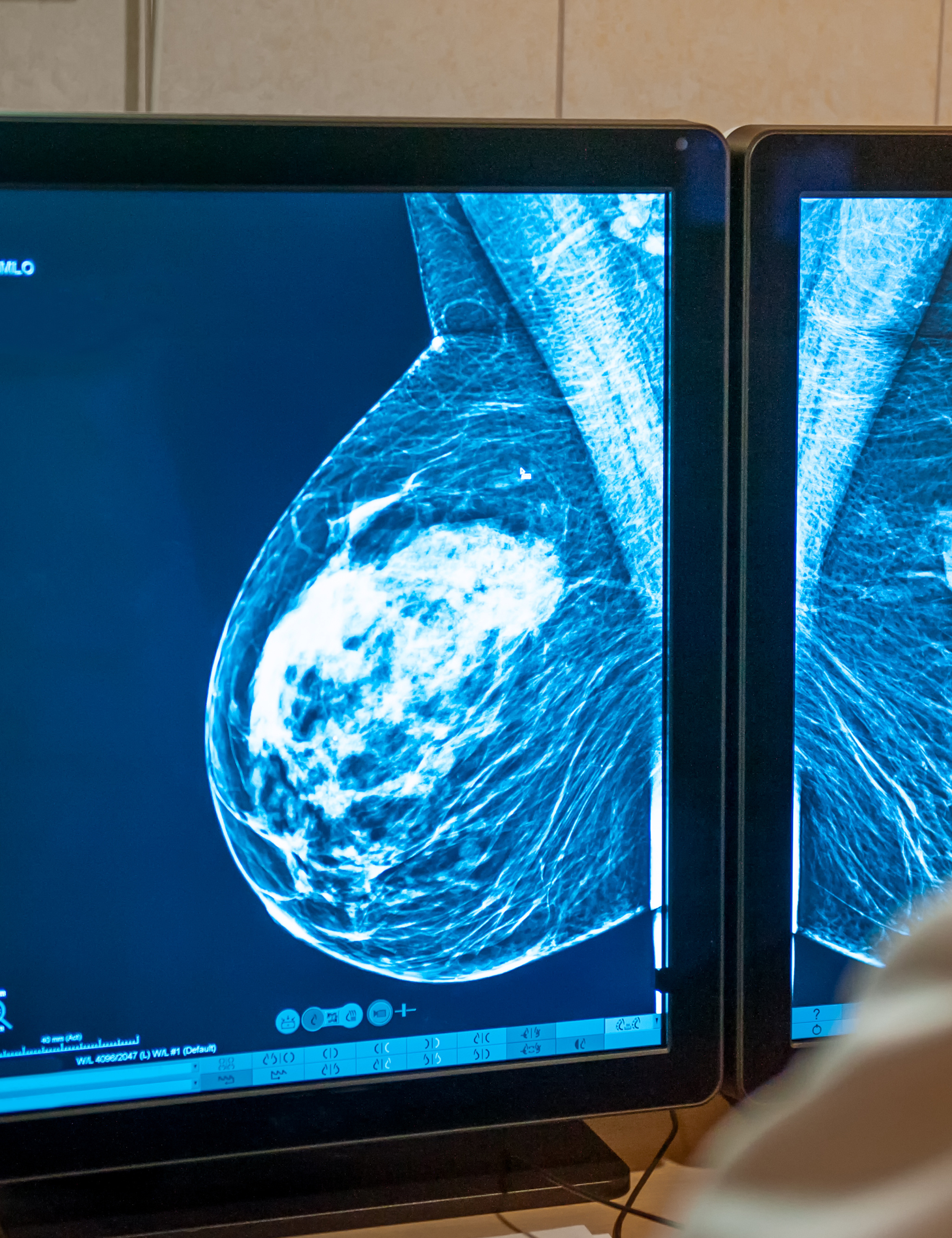 Diagnostic Imaging
